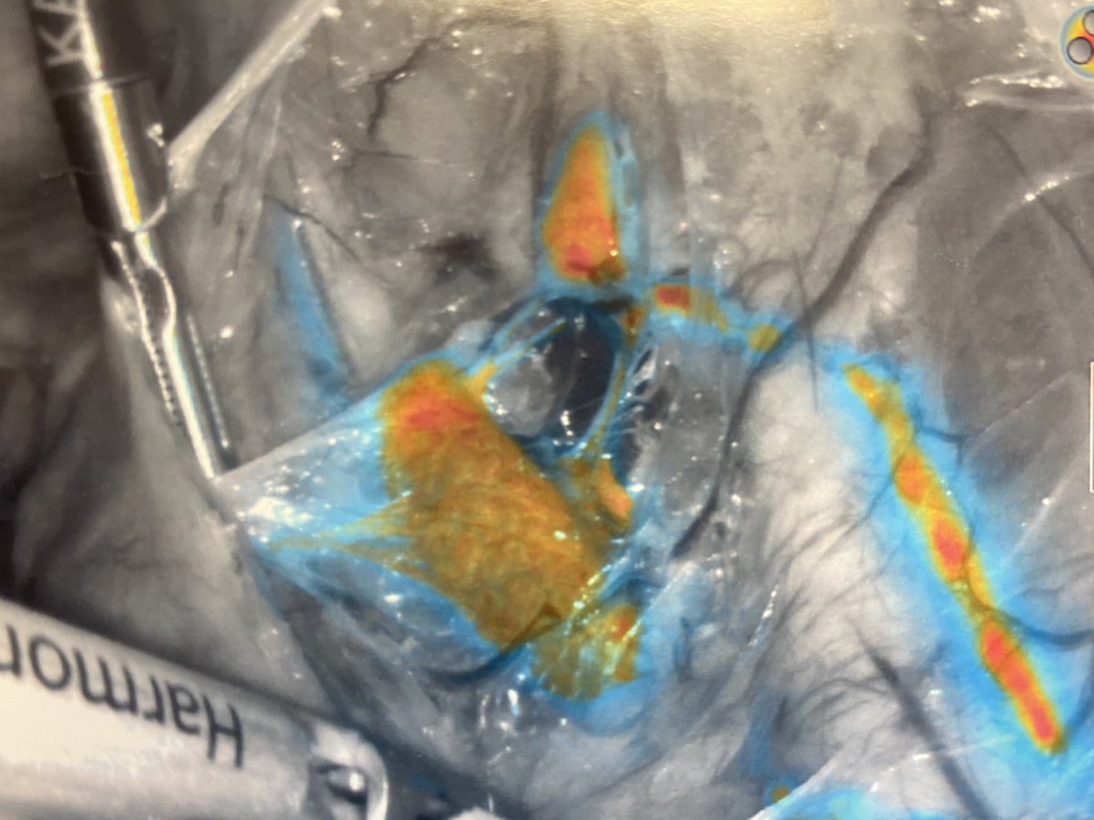 pedroramirezMD's tweet photo. Always a beautiful site! #SLN @IJGCfellows @IJGConline @ESGO_society @IGCSociety https://t.co/A7iBbD8L07