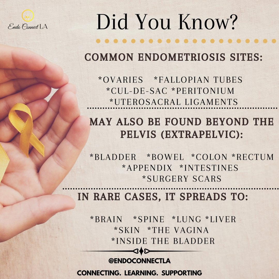EndoConnectLA's tweet photo. #FridayEndoFacts.  Endometriosis is a condition that can impact the whole body.
#EndometriosisAwareness #EndoSupport #Endometriosis #EndoConnectLA https://t.co/xXGC2gjmkV