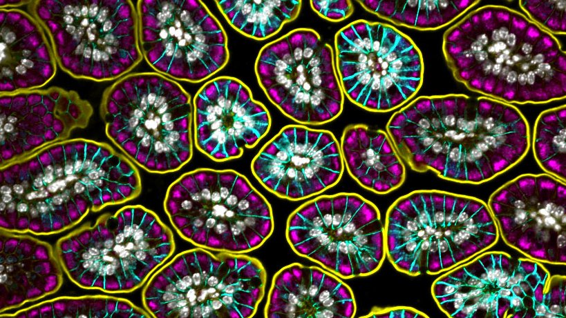 Amy Engevik (@amyengevik) on Twitter photo It has been a long week... happy #fluorescencefriday It has been a long week... happy #fluorescencefriday