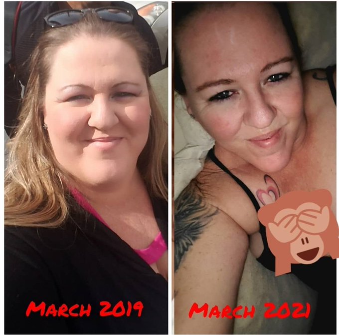I can't stop comparing. It's so crazy to me https://t.co/VFlw3f5Jyp<a href="/tag/transformation"class="tags"><span>#transformation</span></a><a href="/tag/gastricsleeve"class="tags"><span>#gastricsleeve</span></a><a href="/tag/skinremoval"class="tags"><span>#skinremoval</span></a>