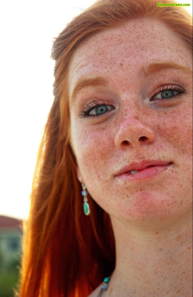 Solo domina mounth freckles