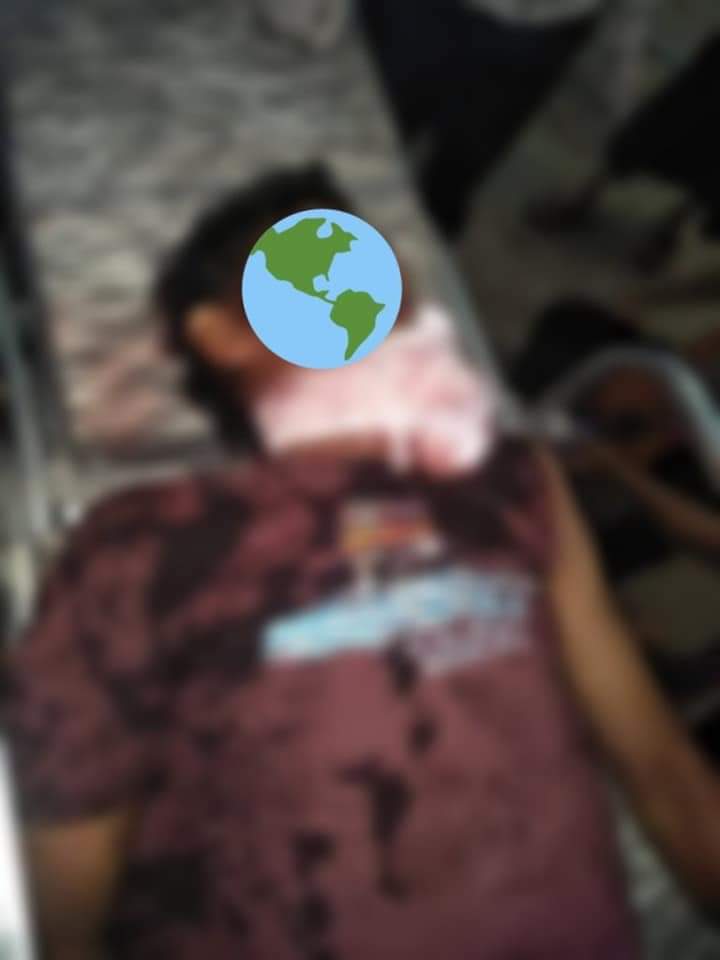 Tw // graphic content // death // blood

The military terrorists brutally killed the two civilians from Thaketa around 12:45 a.m !!! Though one of the dead bodies was got back but another one wasn't got back!!! 

TOWARDS FEDERAL UNION

#WhatsHappeningInMyanmar
#Mar13Coup