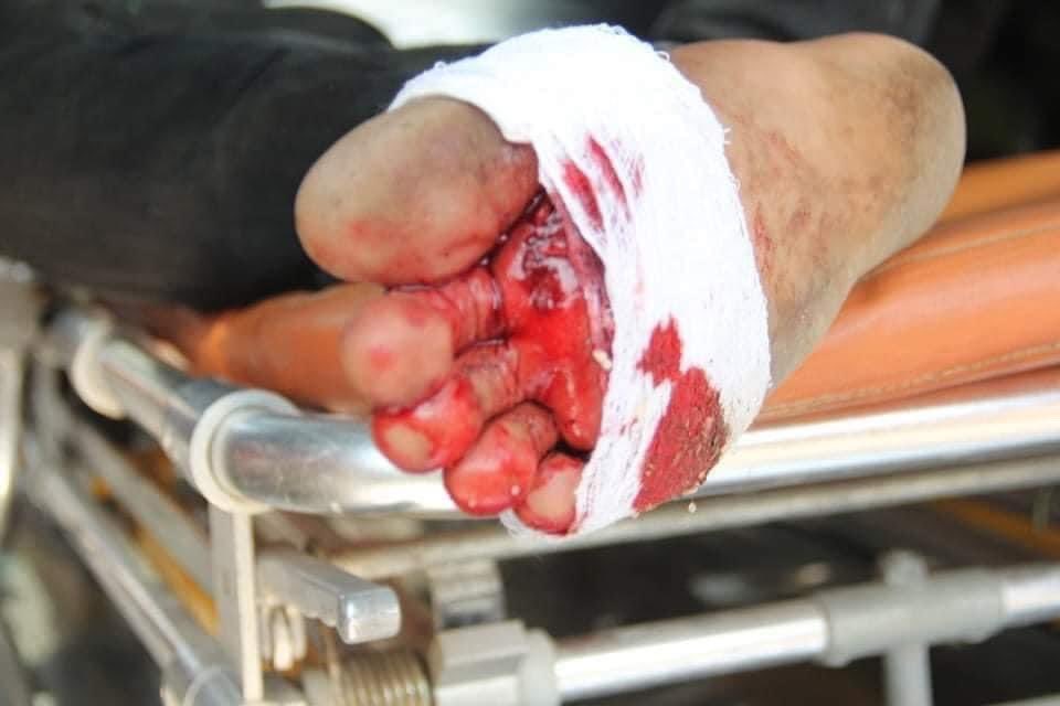 soe zeya tun (@soezeya) on Twitter photo At least two were wounded during the military crackdown a protest in Pyay, Mgway region on Saturday #WhatsHappeningInMyanmar At least two were wounded during the military crackdown a protest in Pyay, Mgway region on Saturday #WhatsHappeningInMyanmar