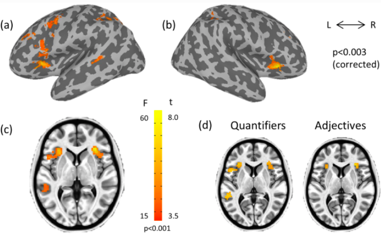 ExpBrainRes's tweet photo. Do you prefer tweets with *few* characters or with *a small number* of characters? Apparently, there is a difference. On how the brain processes #negativePolarity in #quantifiers and in #adjectives, see work by @agmon_galit @ISeeAndSee &amp; Isabelle Deschamps https://t.co/vzIPAWttlA https://t.co/iGFfmLVYtM
