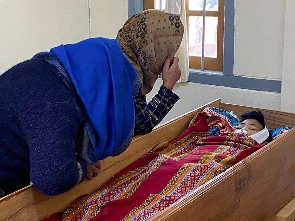 Yesterday, the military terrorists force the patients to discharge from Hakha General Hospital!!! Among these patients , there are people who are in the critical stage!
One patient who are in critical condition passed away this morning!

#WhatsHappeningInMyanmar
#Mar13Coup