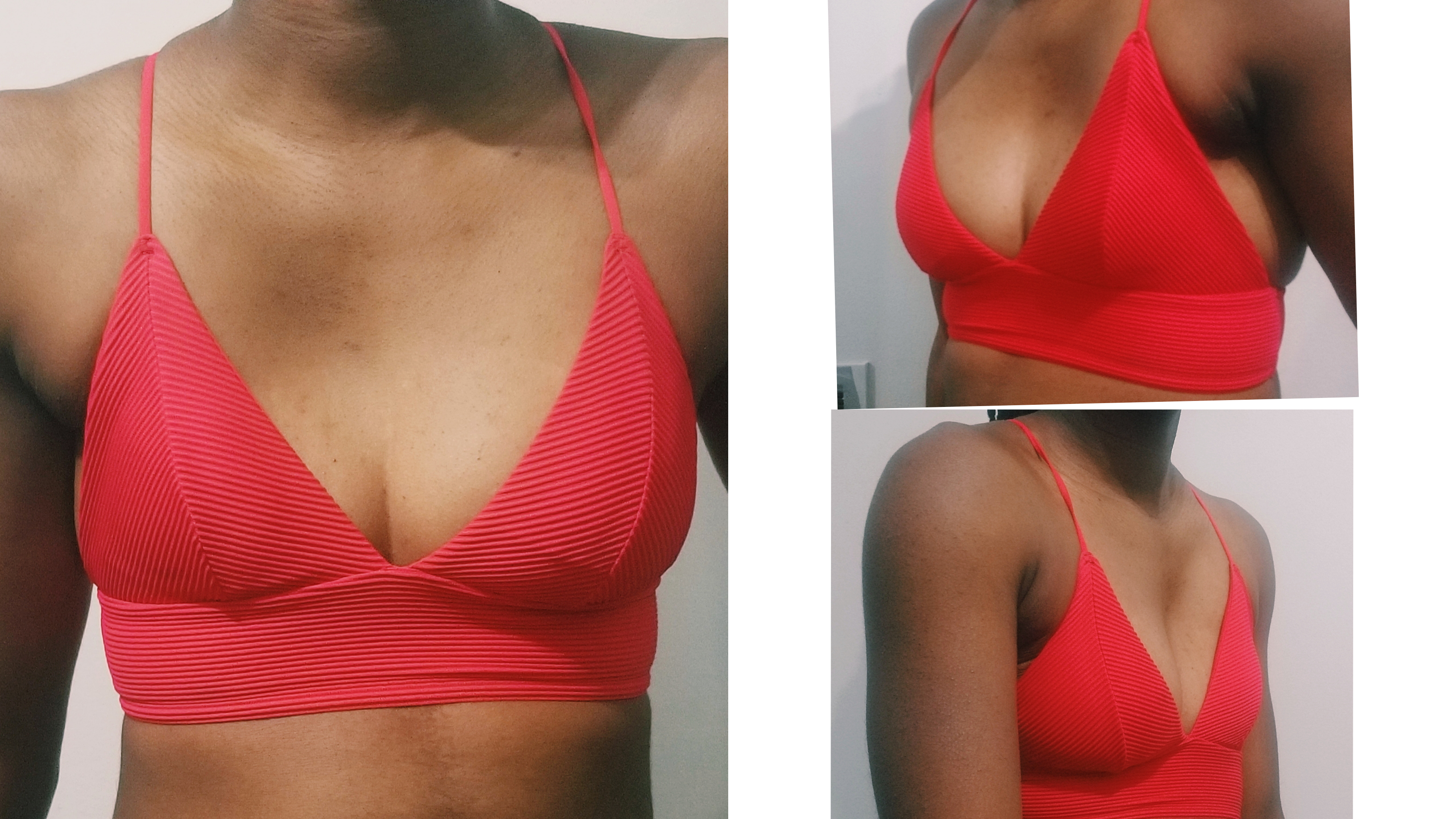 Sheri on X: We can fix the appearance of uneven breasts even in your  snuggest T-shirt or swimwear by using partial prosthesis specially designed  to balance out asymmetrical breasts. #tsmastectomy #prostheses #symmetry #