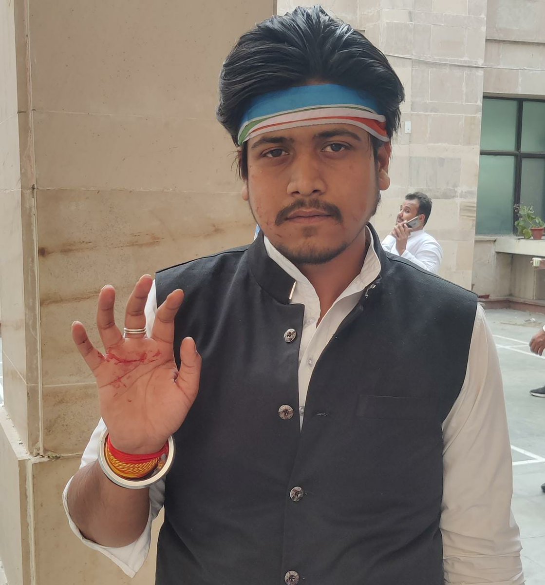 NSUIMP's tweet photo. @nsui द्वारा आयोजित संसद घेराव के दौरान दिल्ली पुलिस द्वारा किए गए बर्बरता पूर्वक लाठीचार्ज में मध्य प्रदेश एनएसयूआई के साथी पार्थ रघुवंशी को गंभीर चोटें आई ।।

 लाठीचार्ज हमारे हौसलो को तोड़ नहीं सकता, हम लगातार छात्रों की आवाज़ उठाते रहेंगे
#StudentsWantJobs https://t.co/6YLKeQDkKs