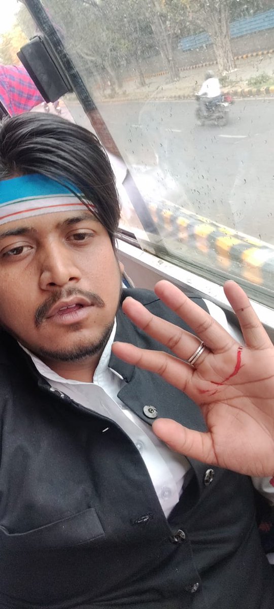 NSUIMP's tweet photo. @nsui द्वारा आयोजित संसद घेराव के दौरान दिल्ली पुलिस द्वारा किए गए बर्बरता पूर्वक लाठीचार्ज में मध्य प्रदेश एनएसयूआई के साथी पार्थ रघुवंशी को गंभीर चोटें आई ।।

 लाठीचार्ज हमारे हौसलो को तोड़ नहीं सकता, हम लगातार छात्रों की आवाज़ उठाते रहेंगे
#StudentsWantJobs https://t.co/6YLKeQDkKs