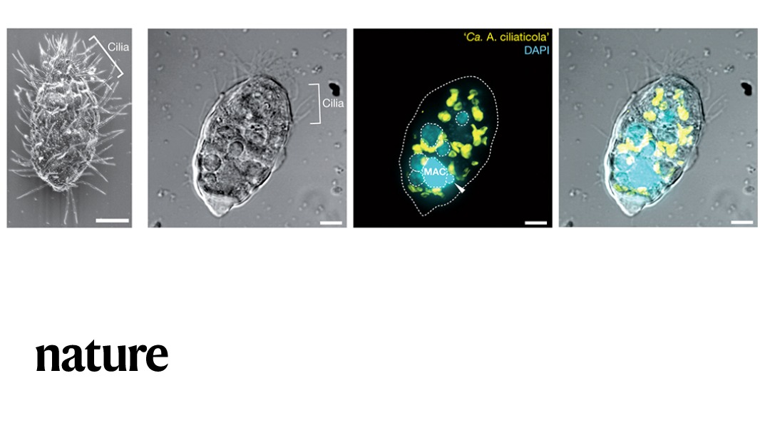 The findings of a study in Nature raises the possibility that eukaryotes with mitochondrial remnants may secondarily acquire energy-providing endosymbionts to complement or replace functions of their mitochondria. go.nature.com/3rsnU8X