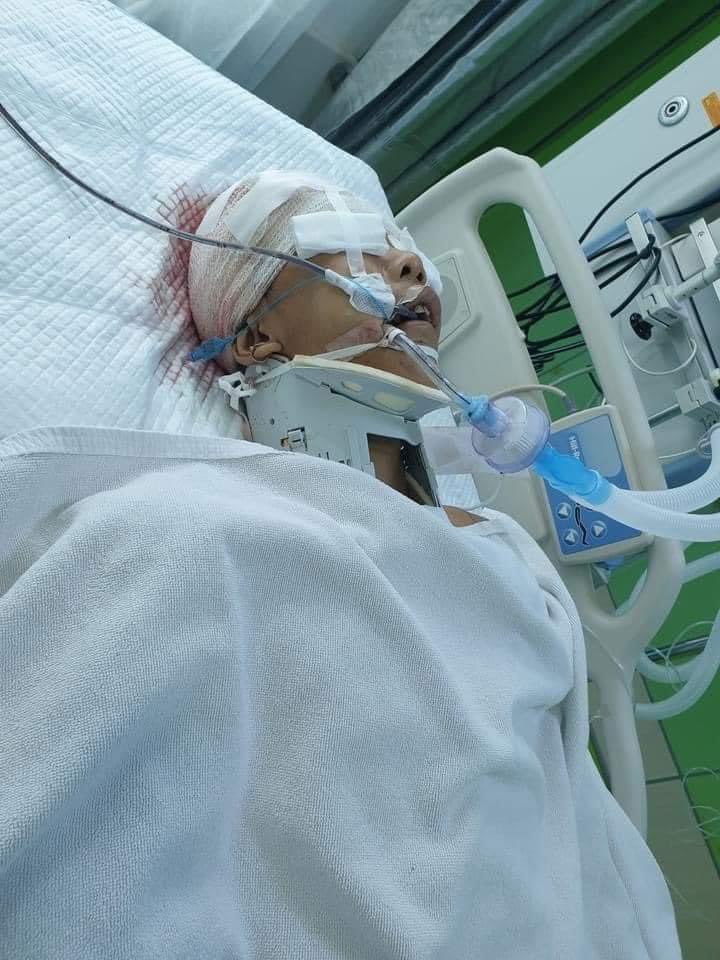 Aung Paing Oo who got shotgun by the terrorist group at yesterday night , Hlaing Tsp is facing with the worst situation now at hospital . <a href="/UN/">United Nations</a> the terrorist groups are cruelly killing the people but you still don't care!!
TOWARDS FEDERAL UNION
#WhatsHappeningInMyanmar 
#Mar13Coup