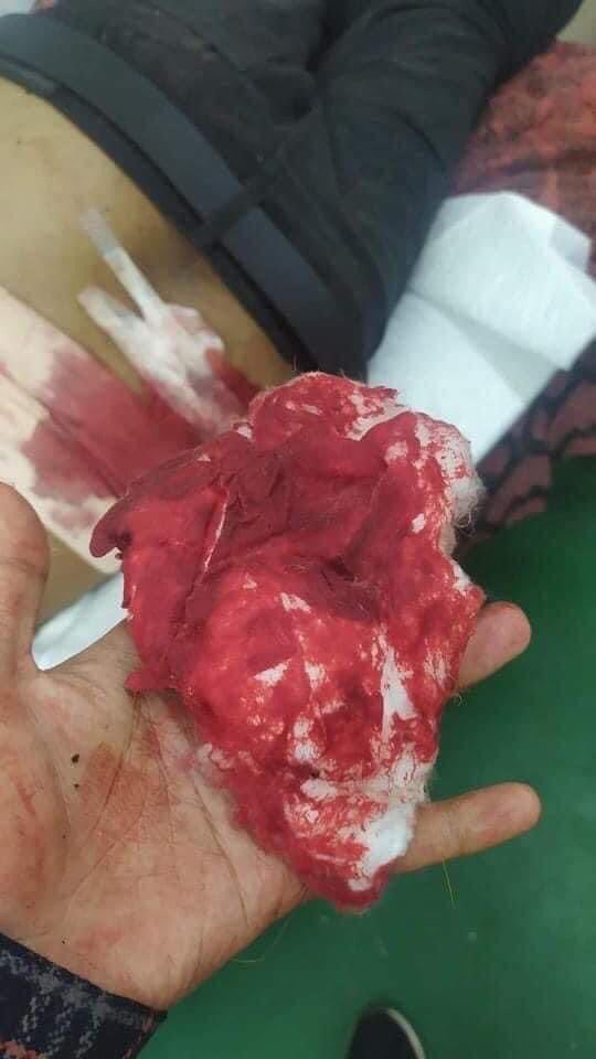 Tw // blood // death

One killed in Pyay Protests; As soldiers used battelfield weapons during crack down on protests, one was shot dead n 5 were in emergency stage due to gunshot wounds on Mar 13.

TOWARD FEDERAL UNION
#Mar13Coup
#WhatsHappeningInMyanmar