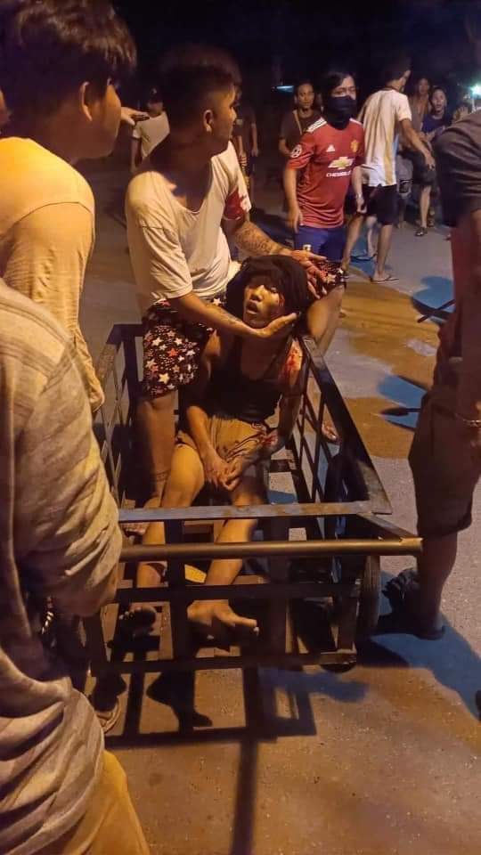 PopChannelMM's tweet photo. Aung Paing Oo who got shotgun by the terrorist group at yesterday night , Hlaing Tsp is facing with the worst situation now at hospital . @UN the terrorist groups are cruelly killing the people but you still don't care!!
TOWARDS FEDERAL UNION
#WhatsHappeningInMyanmar 
#Mar13Coup https://t.co/FP2sPizbCo