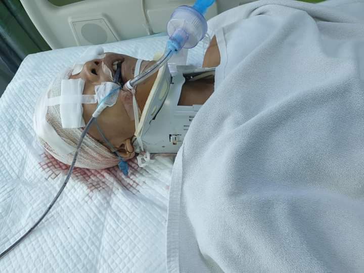 PopChannelMM's tweet photo. Aung Paing Oo who got shotgun by the terrorist group at yesterday night , Hlaing Tsp is facing with the worst situation now at hospital . @UN the terrorist groups are cruelly killing the people but you still don't care!!
TOWARDS FEDERAL UNION
#WhatsHappeningInMyanmar 
#Mar13Coup https://t.co/FP2sPizbCo