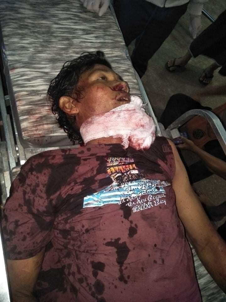 PopChannelMM's tweet photo. TW // Blood
Yangon: Terrorists forces are continuously shooting in Tharkayta Tsp. One civilan shot dead n at least two injured in critical condition. Just about time for internet cut. 

#WhatsHappeningInMyanmar 
#Mar13Coup https://t.co/KP3Gl0FeDX