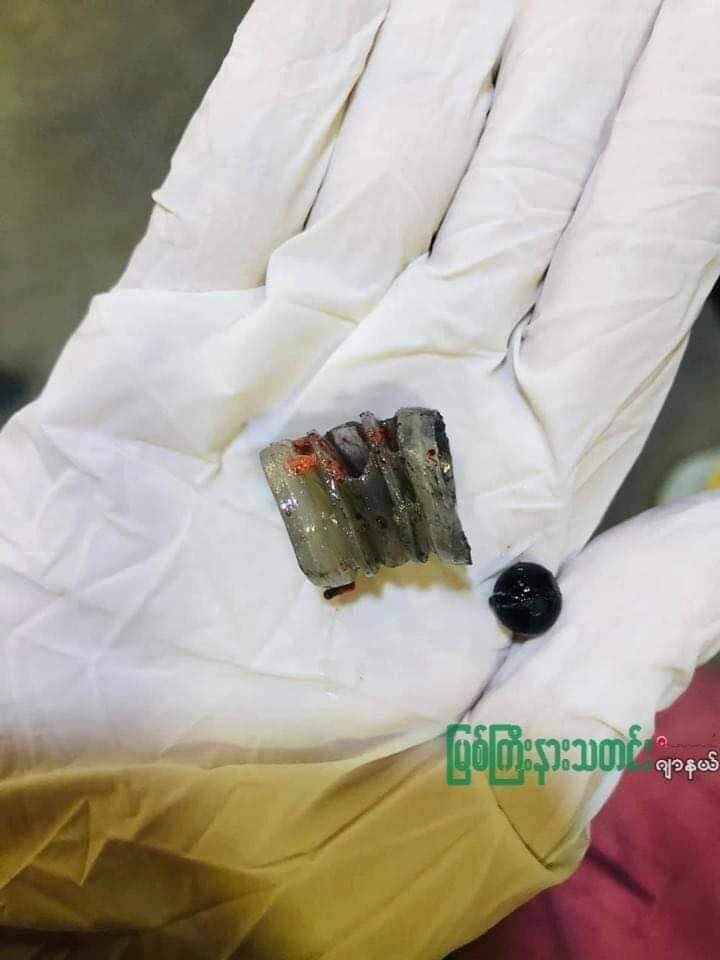 HulkPoe's tweet photo. Tw // wound // blood

Shooting with Rubber Bullets; This morning , Hapkant township Strike against Regime was cruelly dispersed by riot police! Two peaceful protesters were shot with rubber bullets.

TOWARDS FEDERAL UNION
#Mar13Coup
#WhatsHappeningInMyanmar https://t.co/3GT5sO6BLo