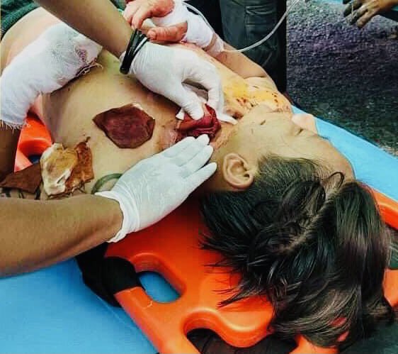 Tw//Blood
March 13, Mandalay
Including a 13-year-old child, monks and a pregnant woman,19 innocent civilians were brutally murdered by the military.Locals said that the pregnant woman was shot in the forehead because she tried to protect the protesters.
#Mar13Coup