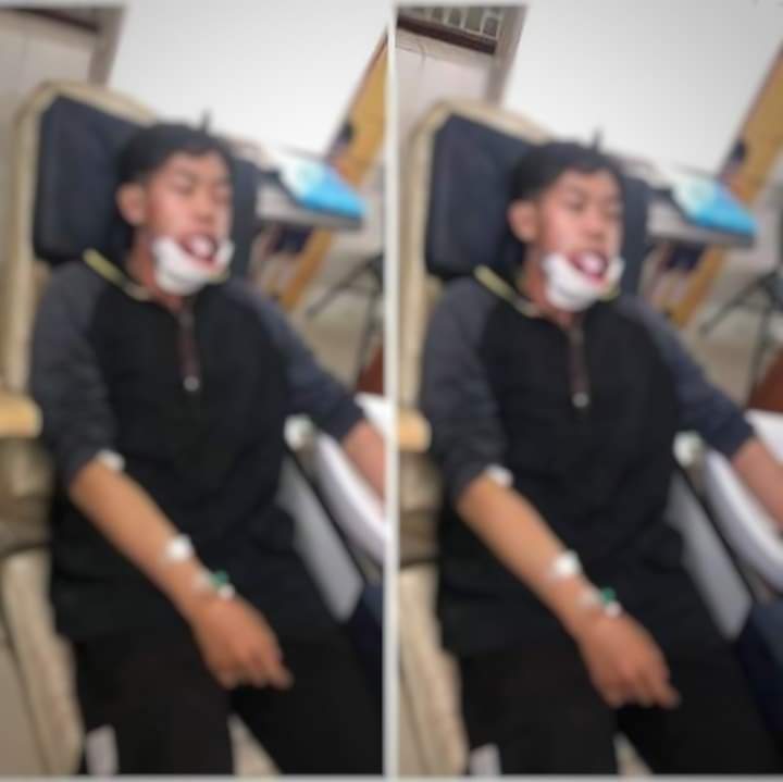 SYitoe's tweet photo. tw // blood,wound      
Happening Now in Pyay,the boy was shot at the entire mouth and his jaw got seriously injured while protesting this Morning.Junta's polices didn't give any warning before they shot.         #WhatsHappeningInMyanmar 
#Mar13Coup https://t.co/GsBEt51XZ5