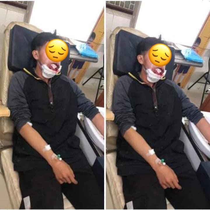 Sue Sha Naing (@patriciassnaing) on Twitter photo In Pyay, the young student was shot in the mouth by military terrorists. His lower jaw got seriously injured. <a href="/UN/">United Nations</a> #WhatsHappeningInMyanmar #Mar13Coup #CrimeAgainstHumanity In Pyay, the young student was shot in the mouth by military terrorists. His lower jaw got seriously injured. <a href="/UN/">United Nations</a> #WhatsHappeningInMyanmar #Mar13Coup #CrimeAgainstHumanity