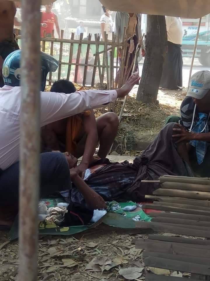 CherryThin18's tweet photo. Tw // blood
A man got shot with real bullet in the chest during violent crackdown by terrorists in Chauk, Magway. He is currently in a critical situation.
TOWARDS FEDERAL UNION
#WhatsHappeningInMyanmar  #Mar13Coup https://t.co/ZmpbUaqase
