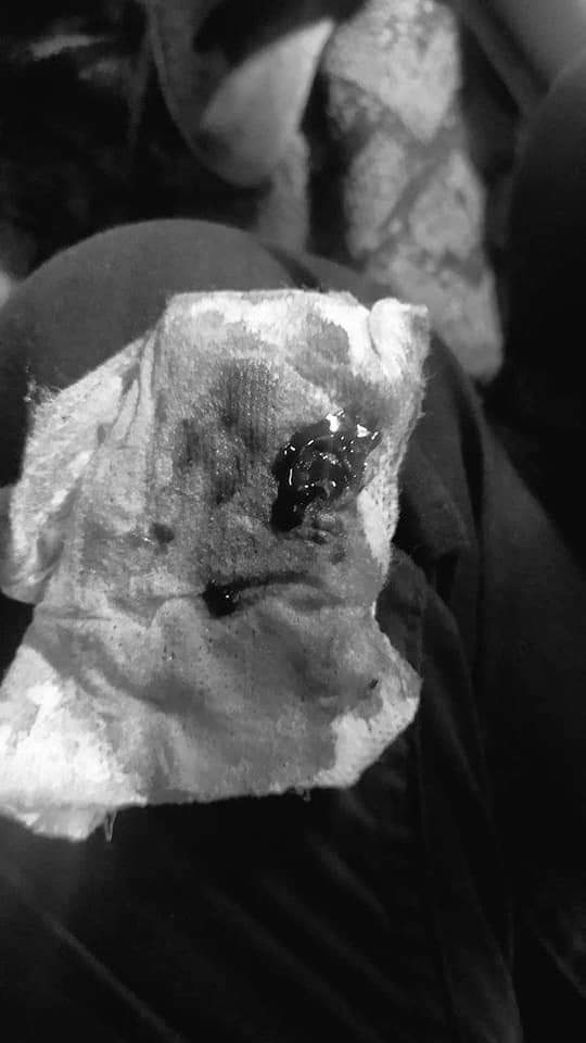 Sammy_MSW's tweet photo. tw // blood // death 
A young boy named Htet Myat Aung was shot in twice to death to the abdomen with live ammunition bullet in Pyay , Bago. 
Rest In Power.   
TOWARDS FEDERAL UNION
#WhatsHappeningInMyanmar
#Mar13Coup https://t.co/CbMc8tMrFb
