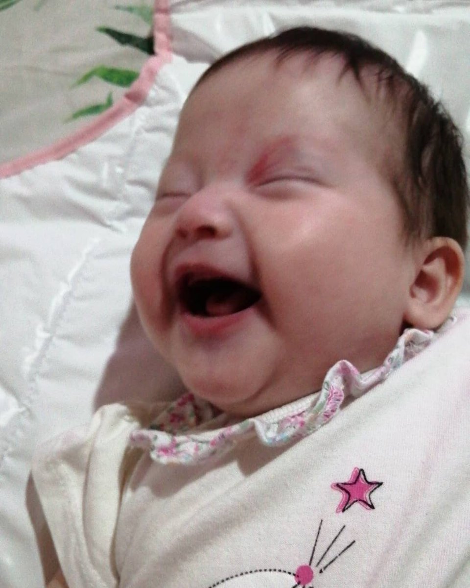 Sara30428072's tweet photo. La sonrisa de una bebe guerrera ante la vida #mielomeningocele #hidrocefaliacomamor #piebot #princedaguerrera https://t.co/CbxQ2uZSaF