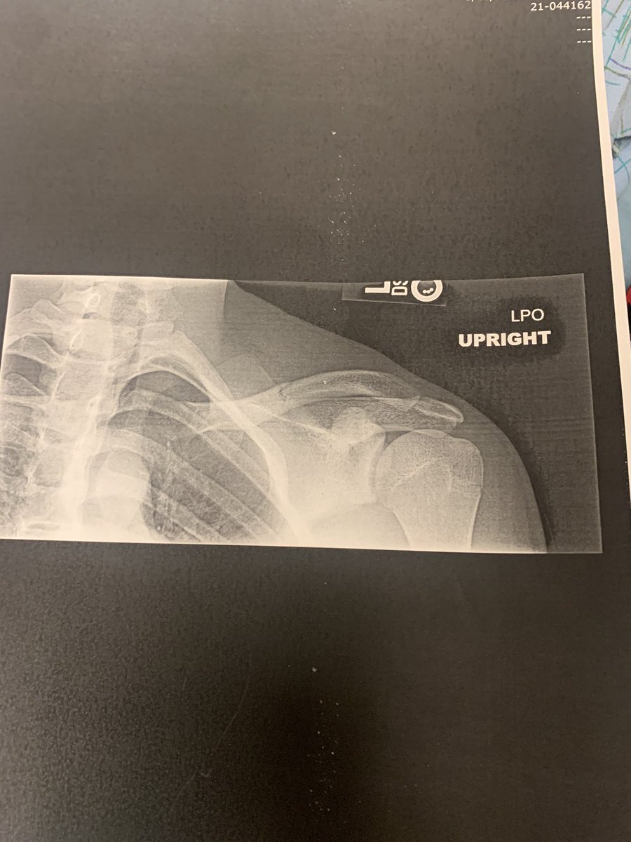 Thank you @CoachMurphIKE <a href="/DdeFootball/">Eisenhower Cardinal Football</a> for a incredible junior year but I am most likely done for this year. Hope to return my senior year! #gocards🔴⚫️⚪️