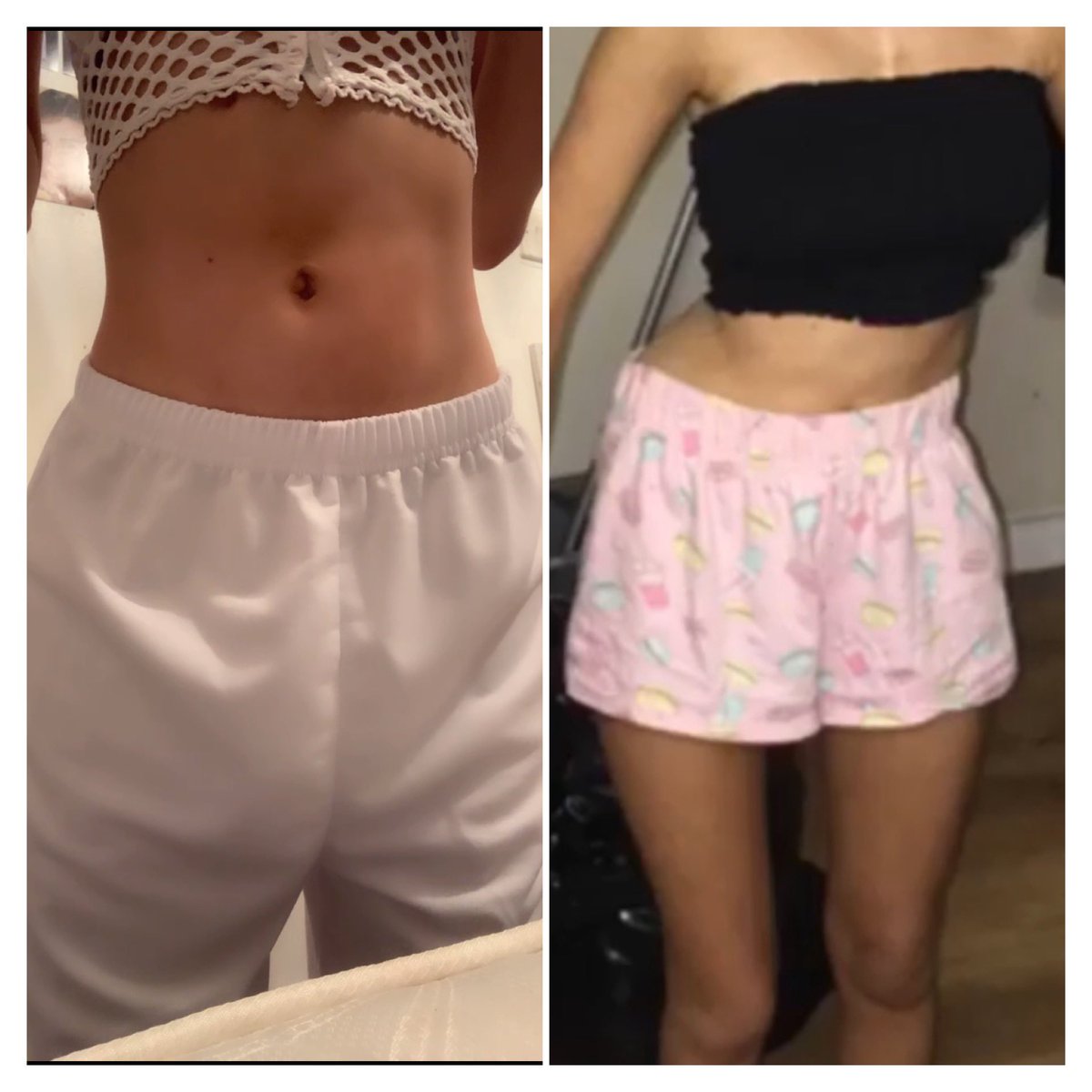 babyyyariii_'s tweet photo. Spreading body positivity! #scoliosis #body #posativity my body has literally changed for the better and and I’m so grateful https://t.co/wTSg0qrKAf