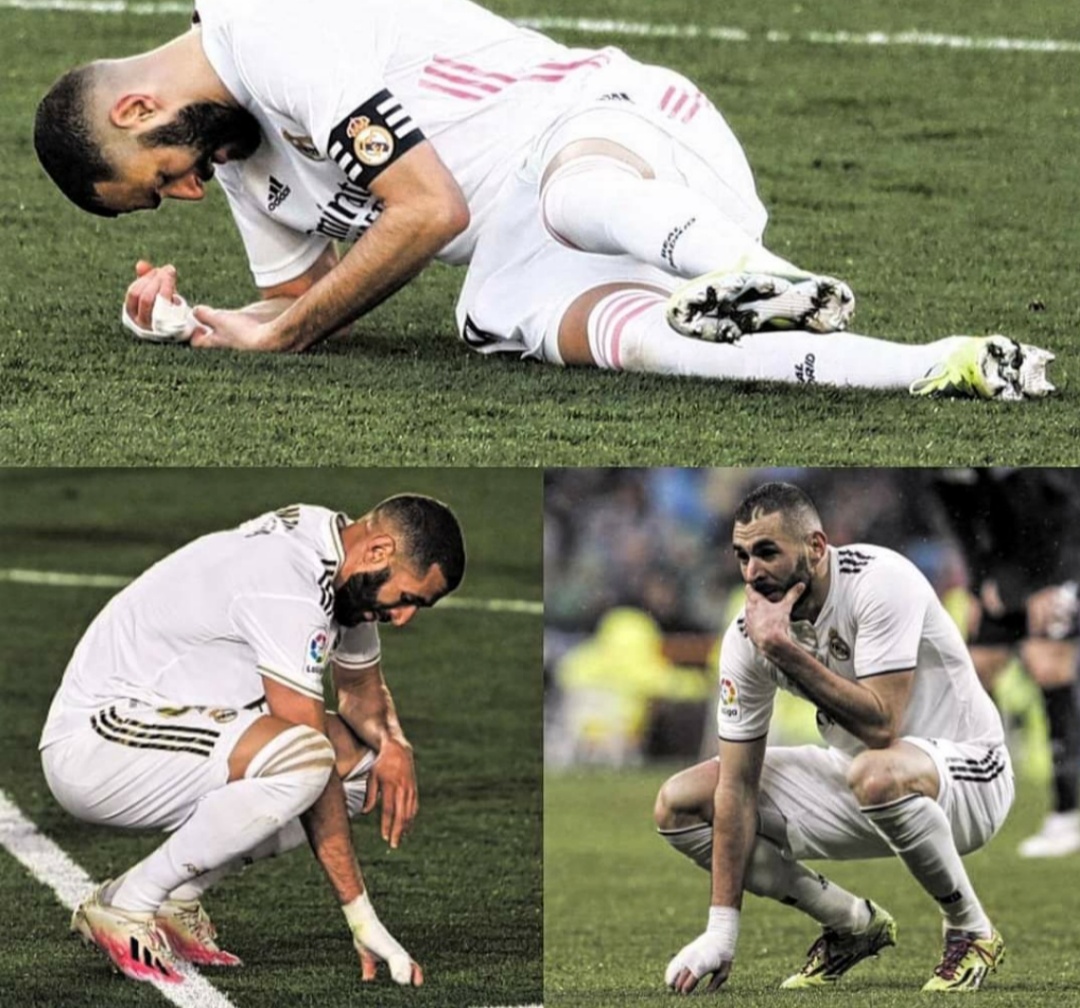 TheClubPark's tweet photo. Benzema's finger is still broken since 2019 and he's been playing through pain ever since, and he refused to have surgery because it would keep him off the pitch for 2 months, and he knows the team needs him. 

RESPECT 🔥 https://t.co/eWoF9rsYLn