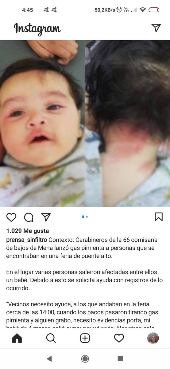 Murieva's tweet photo. @defensorianinez @Carabdechile el peor virus, https://t.co/hvWkWytA8Q