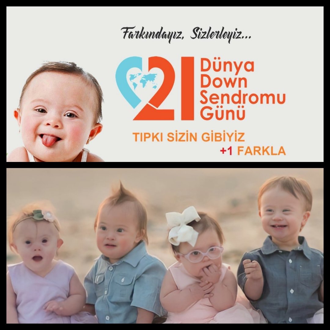 #DownSendromuFarkındalıkGünü