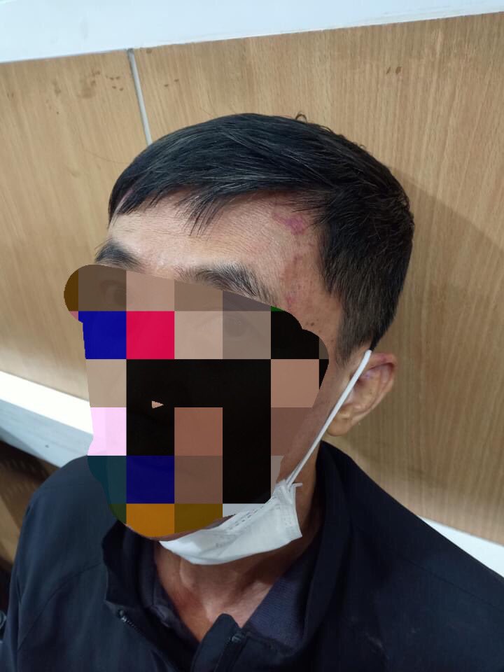 aorwiki's tweet photo. อย่าอ้างว่า ปชช. ทำรุนแรง ยั่วยุ แล้วจะให้ตำรวจทนเหรอ (จะให้ ปชช. รำถวายพวงมาลัยรึไง) พวกมึงมีอาวุธ มีอุปกรณ์พร้อม ส่วน ปชช. เหล่านี้ไม่มีอาวุธสู้ นี่ไม่ใช่รักษาความสงบ นี่คือการทำร้ายร่างกาย��ระชาชน #ตํารวจทําร้ายประชาชน https://t.co/uiXxMQXX02
