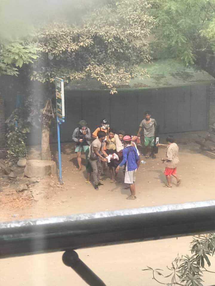 <a href="/cvdom2021/">Civil Disobedience Movement</a> In NanDaWin ward, Monywa; military terrorists shot 3 civillians (one to abdomen &amp; two in leg) around 3PM.

FREEDOM OF SPEECH
#WhatsHappeningInMyanmar
#Mar21Coup