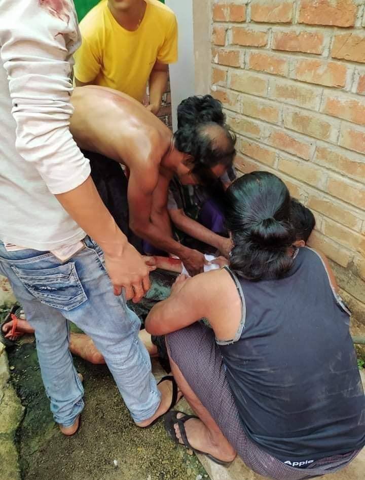 BG_ICEICE's tweet photo. tw // blood
In PoneNar Su 5 Road, Bago,
a protestor from general strike got gunshot on hand &amp; thigh by violent crackdown of terrorists.
LOCOMOTIVE XYZ
#WhatsHappeningInMyanmar
#Mar14Coup https://t.co/EAUtLnLPGx