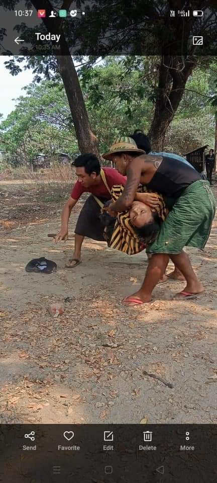 Jacobs59461215's tweet photo. မီဒီယာမရှိတဲ့ ပဲခူးမြို့အတွက်ဝိုင်းကူပြီး အသံထွက်ပေးကြပါ 🙏🏼
၁. ထက်ကိုကိုလွင် - ပေါင်နဲ့ လက် သေနတ် ၂ချက်ထိ
၂. အမည်မသိ - ရင်ဘက်ထုပ်ချင်းပေါက် (သေဆုံး) 
၃. အမည်မသိ - ပခုံးသေနတ်ထိ 
14.03.2021 
ခုထိ ဖြိုခွင်းခံနေရပါတယ်

Source..https://t.co/RBun1jFbIS https://t.co/Q366cuyMAE