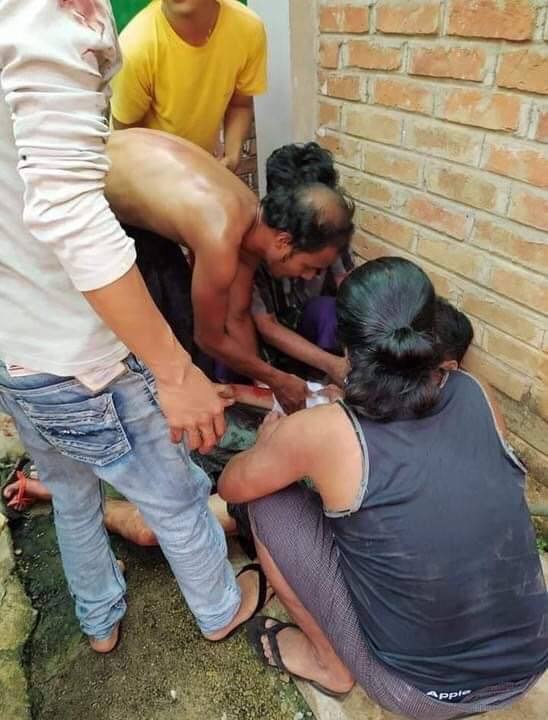 Tw // blood // wound 

Happening in Bago; 1 Killed, 5 seriously injured in shooting at Bago Demo crowd on Mar 14. One who has fallen on the spot was shot in abodmen. Military is uncontrollably committing crimes against humanity.

LOCOMOTIVE XYZ
#Mar14Coup
#WhatsHappeningInMyanmar