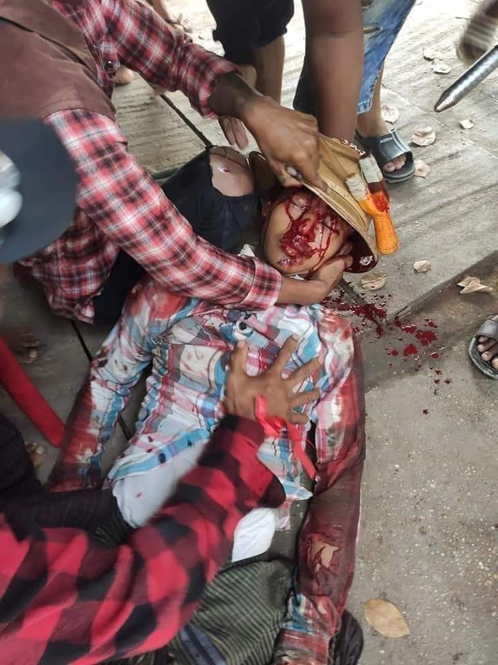 #WhatsHappeningInMyanmar
#Mar14Coup