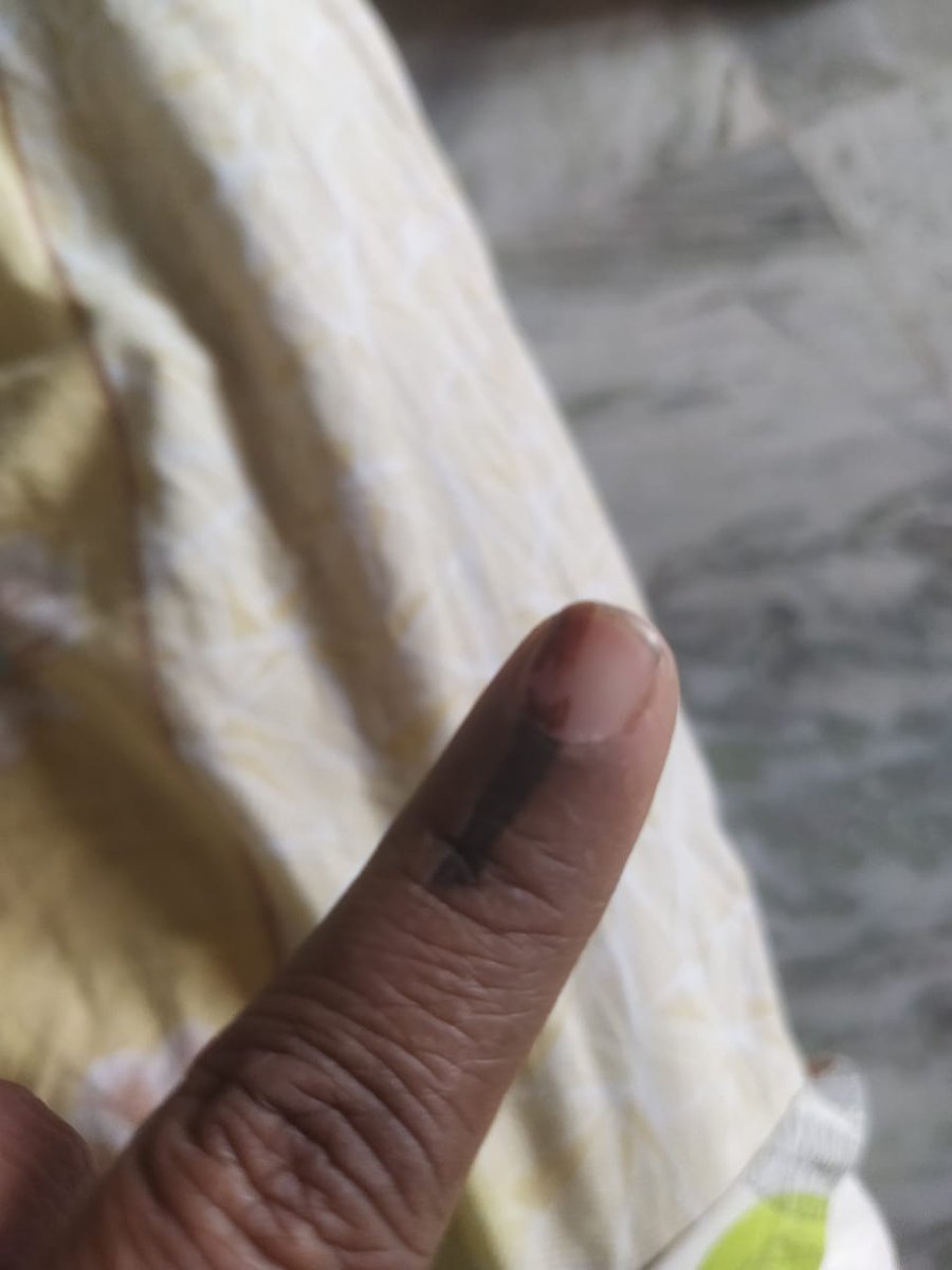 ramu_marikanti's tweet photo. My sister got p' inked !
#ఖమ్మం లాంటి ఇ ద్వితీయ శ్రేణి నగరాలకు ఐటి హబ్ ( IT HUB) తీసుకొచ్చిన పార్టీకే మా ఓటు అంటున్న గ్రాడ్యుయేట్స్ !!
@KTRTRS @trsinnews @trspartyonline #VoteForPalla
#votefordevelopment! https://t.co/DMKUZozafW