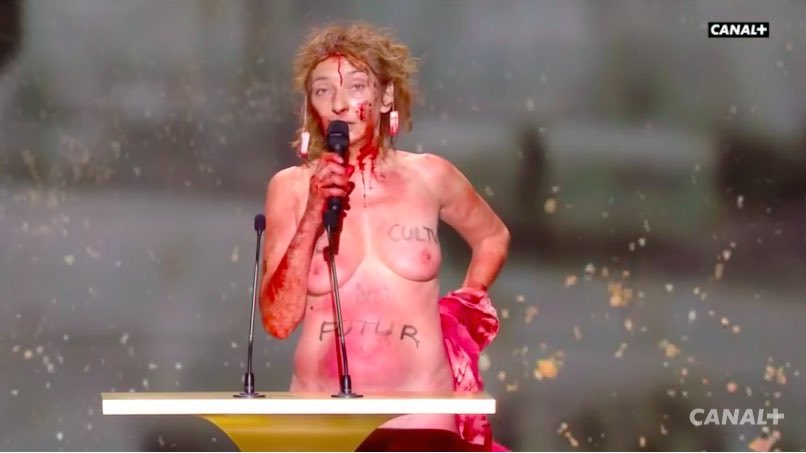 Quelle laideur . Quel naufrage. Quel effondrement. Quelle déroute. Quelle faillite. Quelle perdition. Quelle abjection. Quelle difformité. Quelle ignominie. Quelle disgrâce. Et même quelle hideur morale.