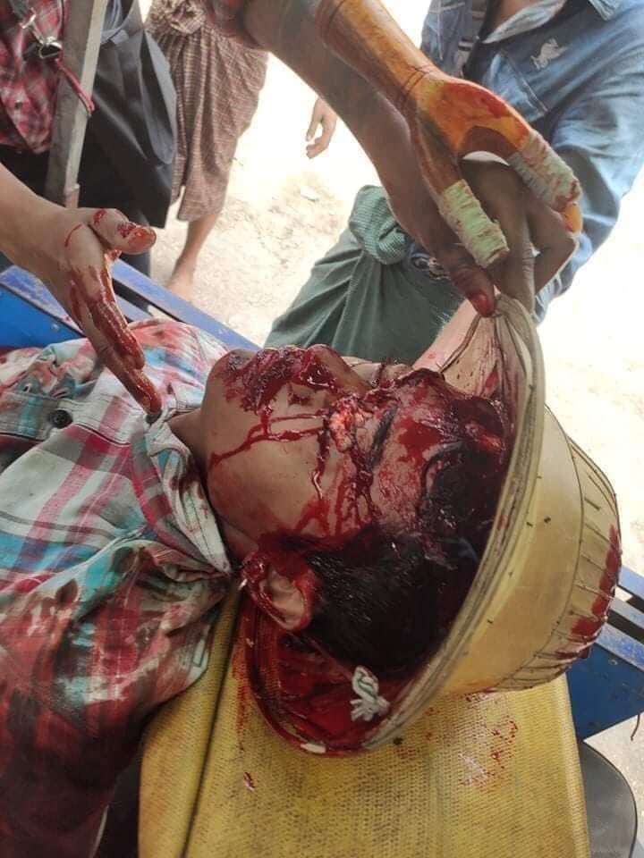 #Save Myanmar <a href="/UNHumanRights/">UN Human Rights</a>