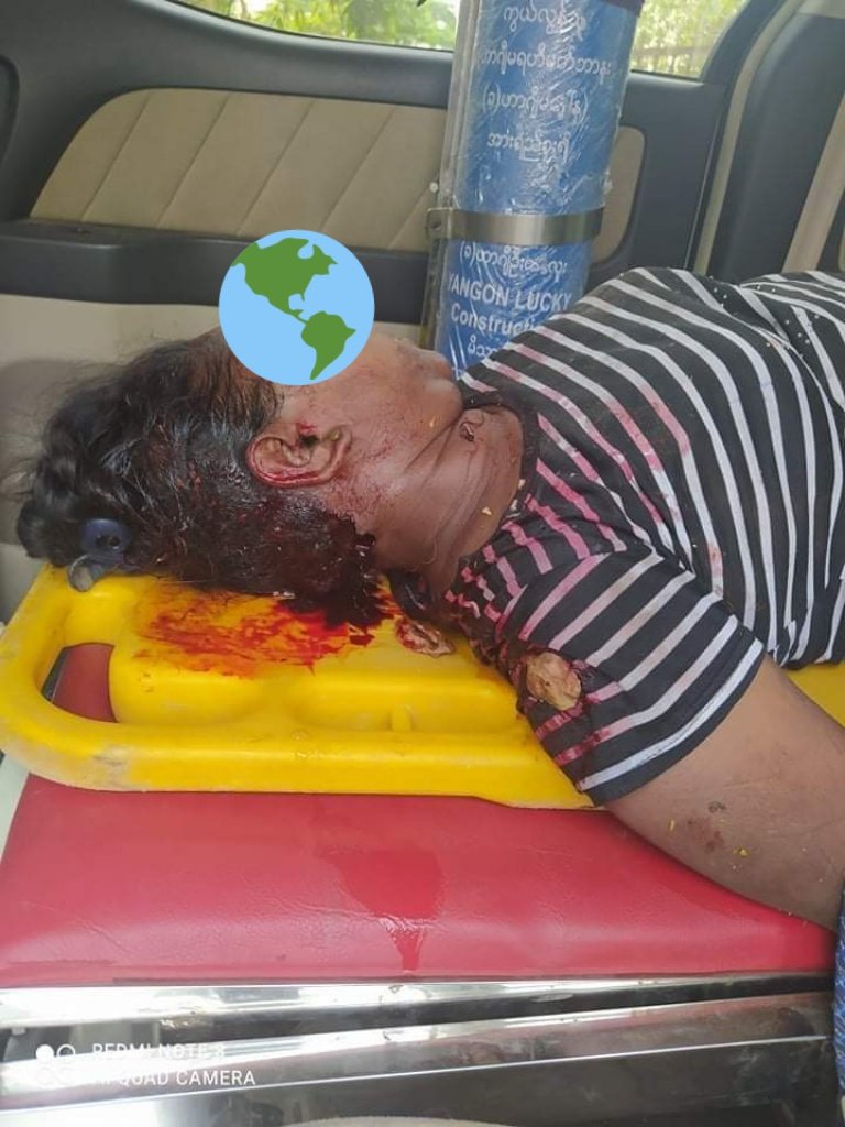 Tw // blood // dead body
A woman was found dead inside the roadside gutter in Ghonesaykyun,Bago.
Locals said that she was shot dead by the military junta &amp; her body was concealed where she was found!
What a deadliest day again!

LOCOMOTIVE XYZ
#Mar14Coup
#WhatsHappeningInMyanmar