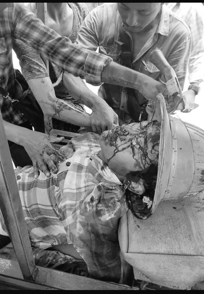 NwayOoKhin8's tweet photo. tw // blood 
In Hlaing Thar Ya,Yangon 🚨
Junta’s Terrorists still shooting with live ammunitions to protesters.
Many people got injured right now❗
LOCOMOTIVE XYZ
#WhatsHappeningInMyanmar
#Mar14Coup https://t.co/AcFlCwb82Q