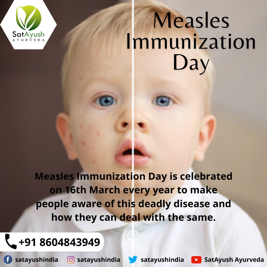 As per the revised routine #immunization schedule by the #WorldHealthOrganization, every child should get two doses of the #measlesvaccine. The 1st dose at the #age of 9-12 months and the 2nd dose at the age of 16-24 months.

#satayush  #measlesimmunizationday