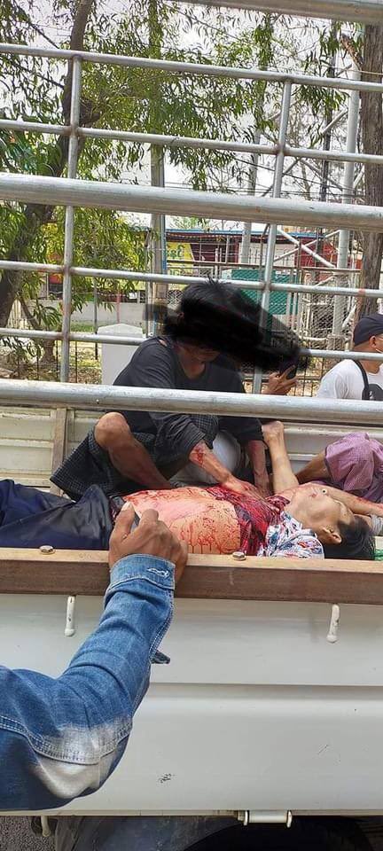 MilkTeaMM_MTAM's tweet photo. Tw//blood ! In HlaingTharYar,two men are shot by real bullets again. The bullets shot by Terrorists even penetrated through the shields in Shwe Pyi Thar. Terrorists are brutally Slaughtering People. LOCOMOTIVE XYZ

#WhatsHappeningInMyanmar
#Mar14Coup #MilkTeaAlliance https://t.co/5aq2g9p8Gc