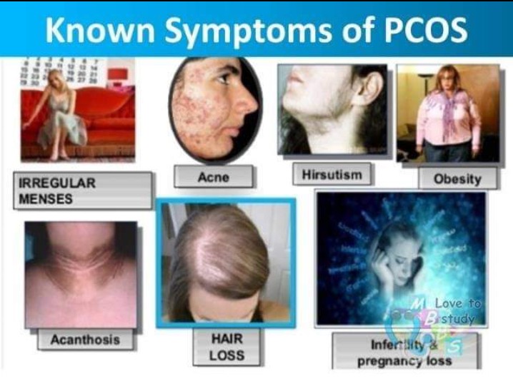imHooRain24's tweet image. I can survive pcos!
#fightPCOS