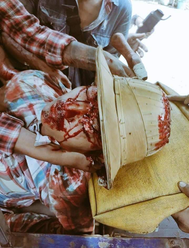 JAYKHIT19's tweet photo. Tw // sensitive content ; 
Devilish Junta attack Hlaing Thar Yar with massive force. At least 10 civilians were killed by Live ammunition. The exact number of deaths is still unknown.

#WhatsHappeningInMyanmar #Mar14Coup @hrw @CIJ_ICJ @RapporteurUn @UN @KenRoth @Juarawee https://t.co/6L4KYBHO8e