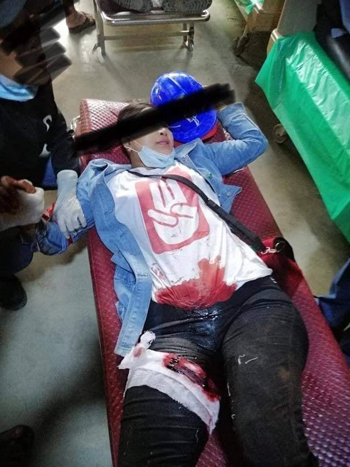 phu_nadi's tweet photo. tw // blood 
In HPAKAN,MyitKyiNar,the peaceful protestors in HpaKan suffered the brutal crackdown by terrorist juntas. At least two got shot. 
LOCOMOTIVE XYZ
#WhatsHappeningInMyanmar
#Mar14Coup https://t.co/tpTbTOOGn9