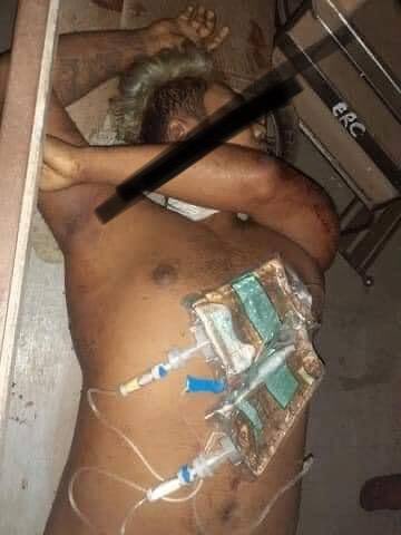 jingjj876's tweet photo. tw // blood // death 
In Thingangyun, Yangon, one was shot in the head, one in hand, one on  mouth, one at chest near heart and one to abdomen. At least 25 got shot and 7 passed away reportedly. Death toll could be increased.
LOCOMOTIVE XYZ
#WhatsHappeningInMyanmar
#Mar14Coup https://t.co/gWdbxeIkUT