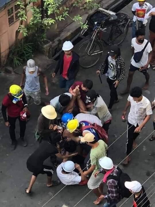 KyisinStella's tweet photo. tw // graphic content 
In North Oakkala, MyaYadana, 
at least two people injured with live ammos due to gunshot of terrorists and one is in critical condition. 
LOCOMOTIVE XYZ
#WhatsHappeningInMyanmar
#Mar14Coup https://t.co/CboYpSNhmd