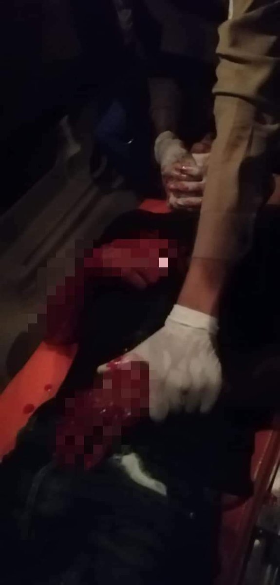 yatana_pn's tweet photo. LOCOMOTIVE XYZ
3 died and many injured in hours of shooting in South Dagon n it's hard to get medical treatment cuz of continuous shooting.According to local,thugs use machine guns and https://t.co/jcV96nKzbs's still shooting in South Dagon until 10:29PM
#WhatsHappeningInMyanmar https://t.co/ShT6af3wJT
