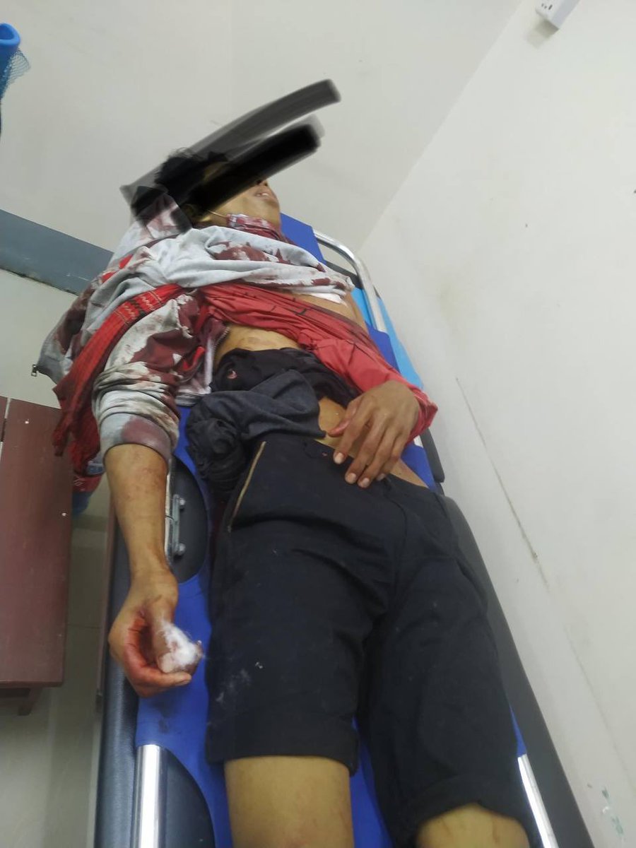 John.Frenzo (@johnstifflerkzy) on Twitter photo tw // blood // death 
In Phayar Road, ThinGanGyun, Yangon, one was shot to death with live ammunition by terrorists. We are losing so many lives all over Myanmar.
LOCOMOTIVE XYZ
#WhatsHappeningInMyanmar
#Mar14Coup tw // blood // death 
In Phayar Road, ThinGanGyun, Yangon, one was shot to death with live ammunition by terrorists. We are losing so many lives all over Myanmar.
LOCOMOTIVE XYZ
#WhatsHappeningInMyanmar
#Mar14Coup